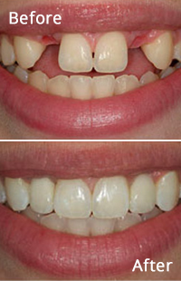 Baltimore Cosmetic Dentistry