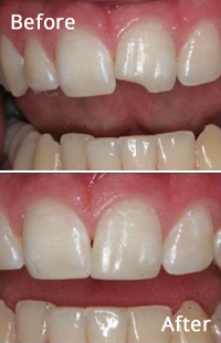 Cosmetic Dentistry in Baltimore